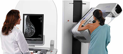 Mammografia 1 Aktis Clinique Radiologia