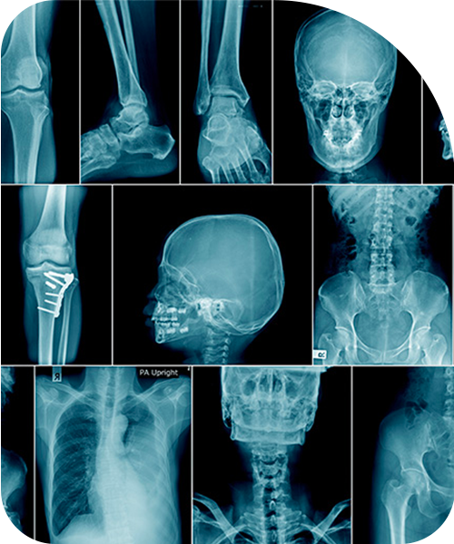 Radiologia 2 Aktis Clinique Radiologia